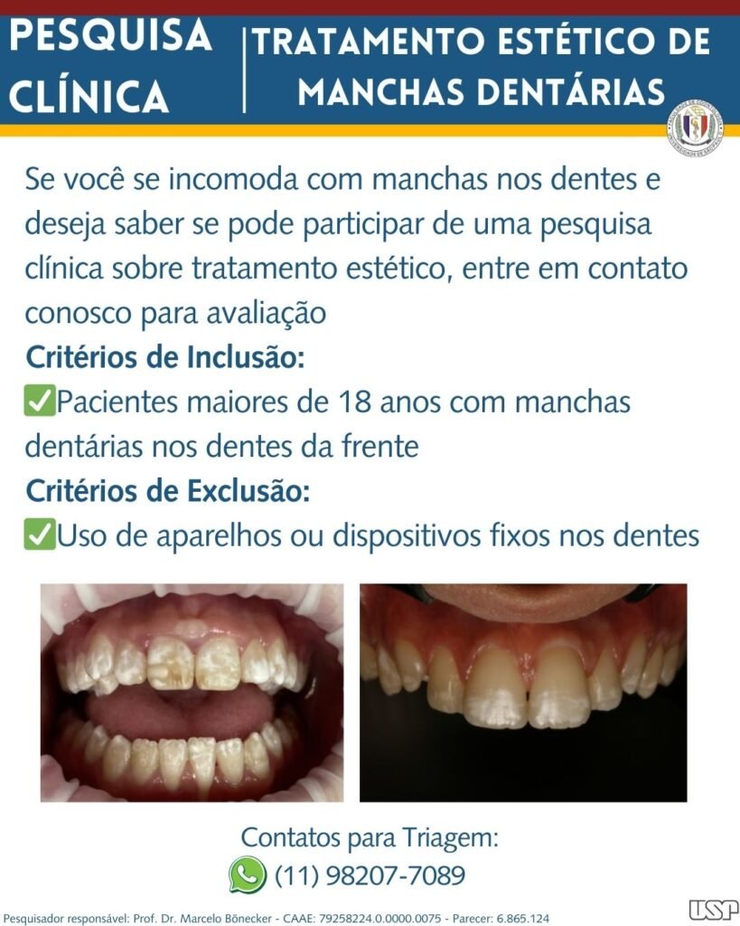 Leia mais sobre o artigo Tratamento estético de manchas dentárias